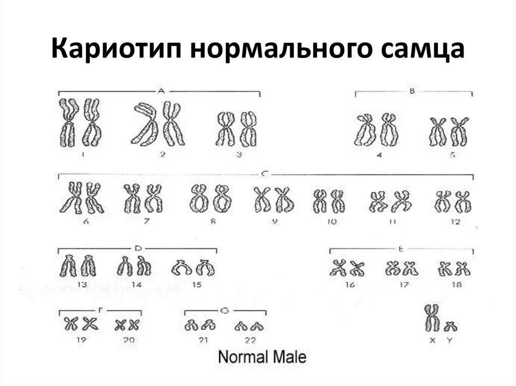 Кариотип человека определяют