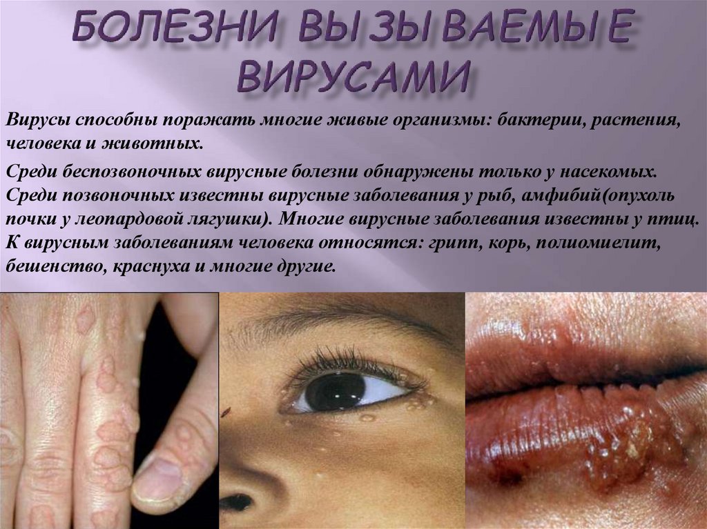Болезни вызываемые вирусами