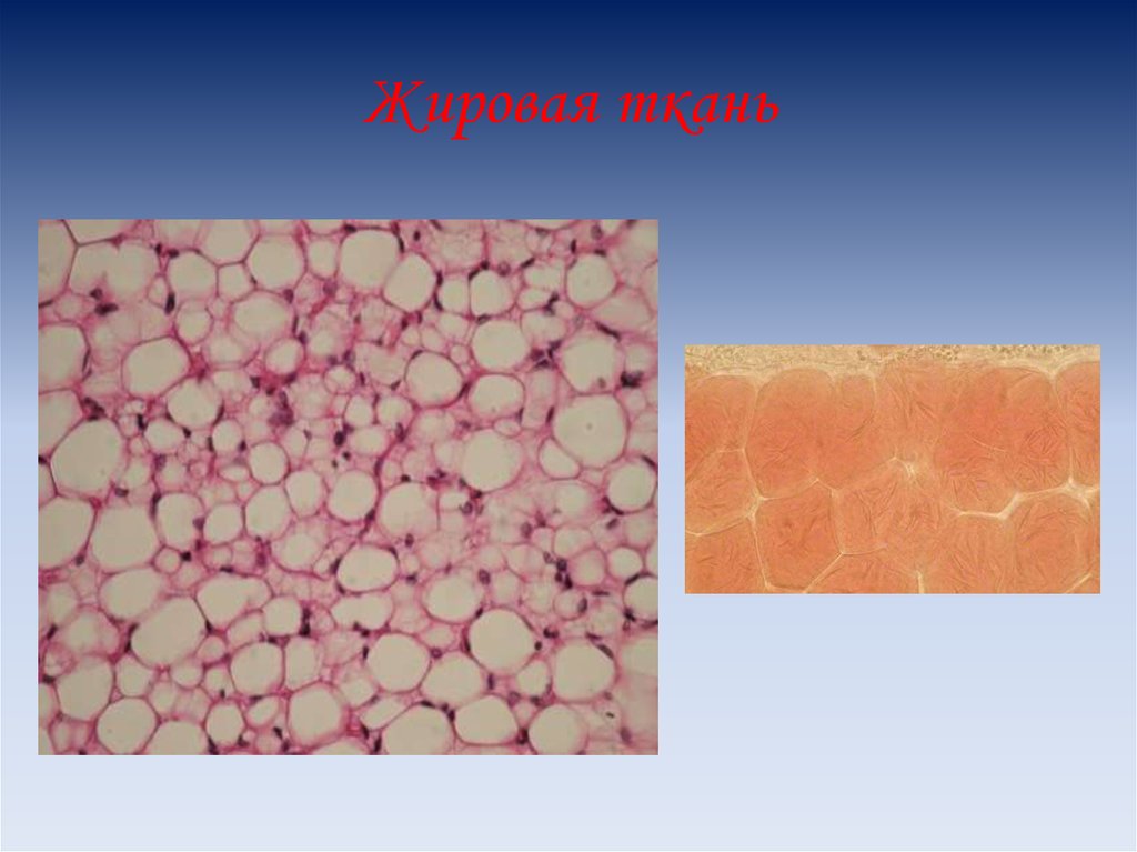 Липоциты. Жировая ткань гистопрепарат. Жировая ткань строение гистология. Жировые клетки соединительной ткани. Жировая соединительная ткань под микроскопом.