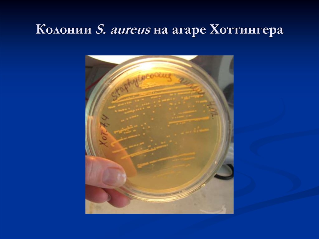 Приготовление сахарного бульона микробиология