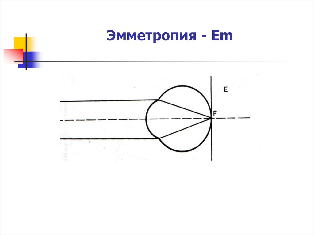 Рефракция эмметропия