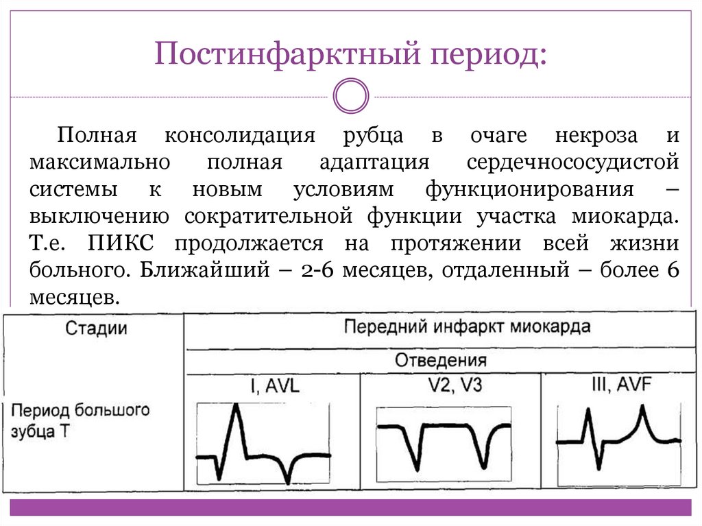 Пред нфарктный вз мать