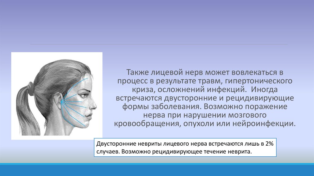 Невропатия лицевого нерва лечение