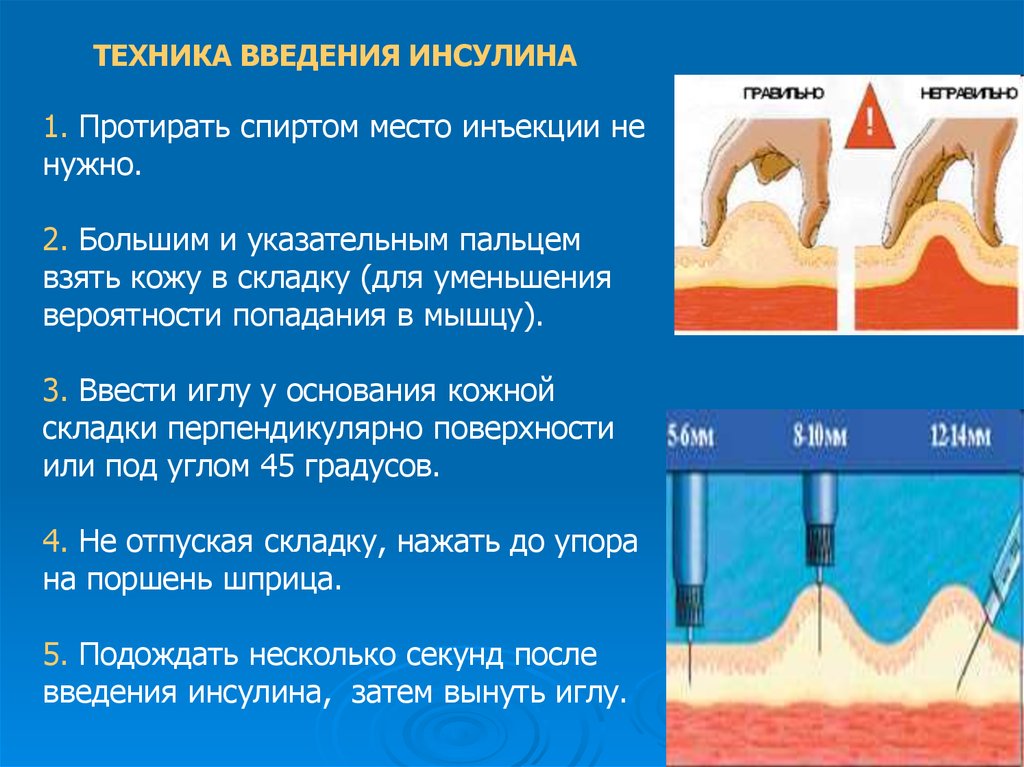 Инъекции инсулина кожа. Подкожное Введение инсулина алгоритм. Алгоритм введения подкожной инъекции инсулина. Алгоритм выполнения манипуляции введения инсулина. Продемонстрируйте технику п/к введения инсулина..