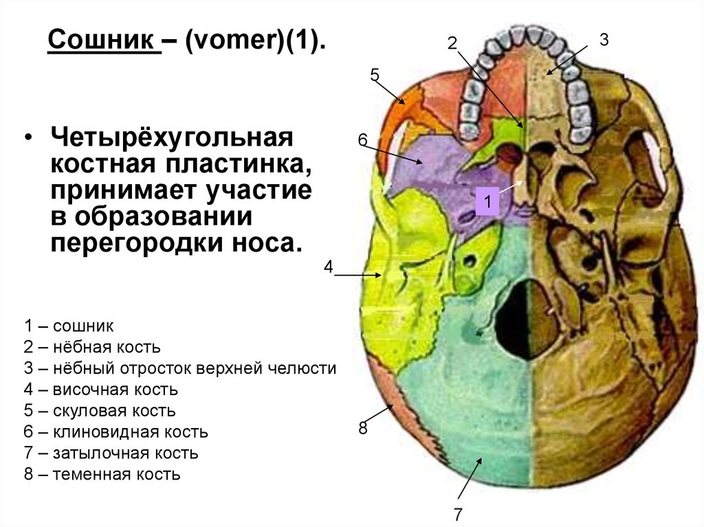 Сошник кость. Кости черепа сошник. Сошник черепа анатомия. Сошник кость анатомия. Строение черепа сошник.