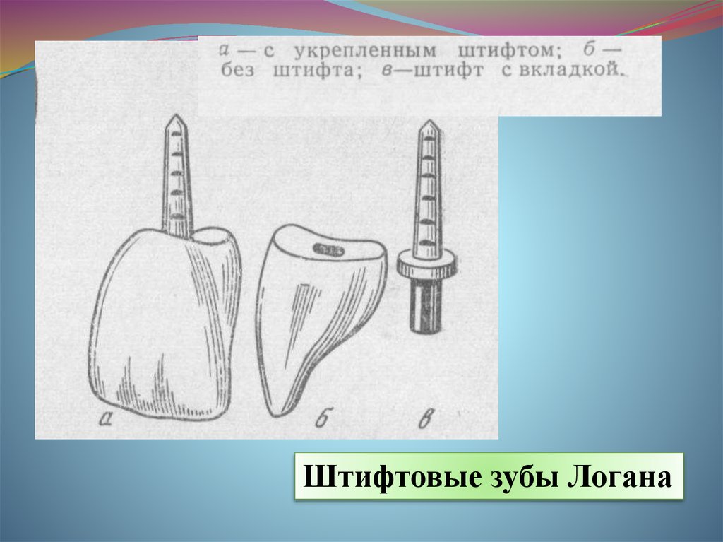 Штифтовые зубы презентация