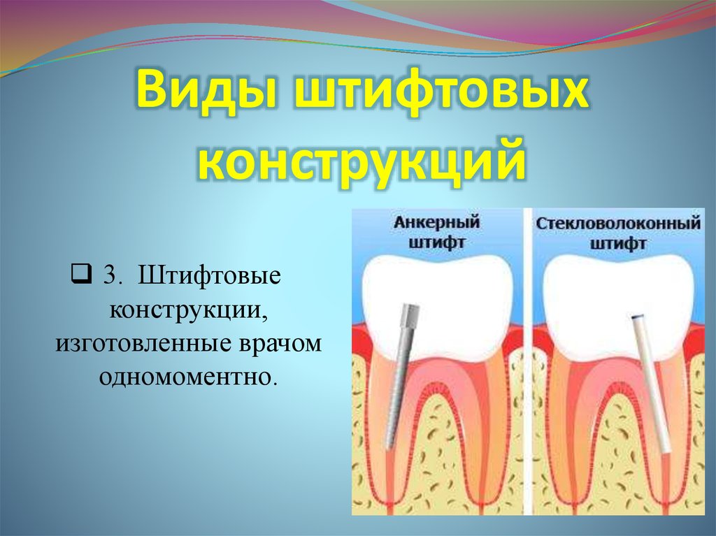 Штифтовые зубы презентация