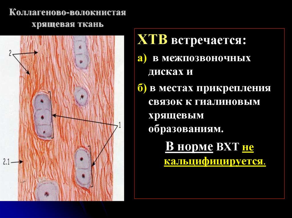 Волокнистый хрящ гистология