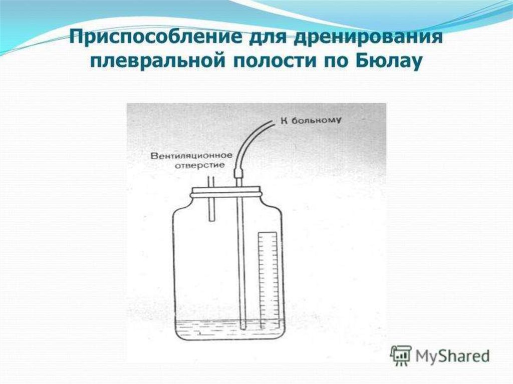 Дренирование плевральной полости. Набор для дренирования плевральной полости размер 23. Аппарат Боброва для плевральной полости. Система активной аспирации из плевральной полости.