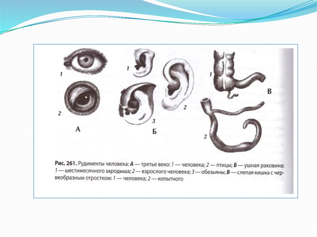 Рудименты человека. Эпикантус рудимент. Третье веко у человека рудимент. Третье веко у человека это рудимент или атавизм. Третий глаз у человека рудимент.