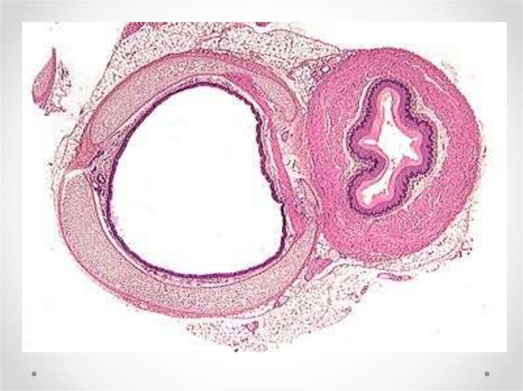 Трахея гистология препарат рисунок