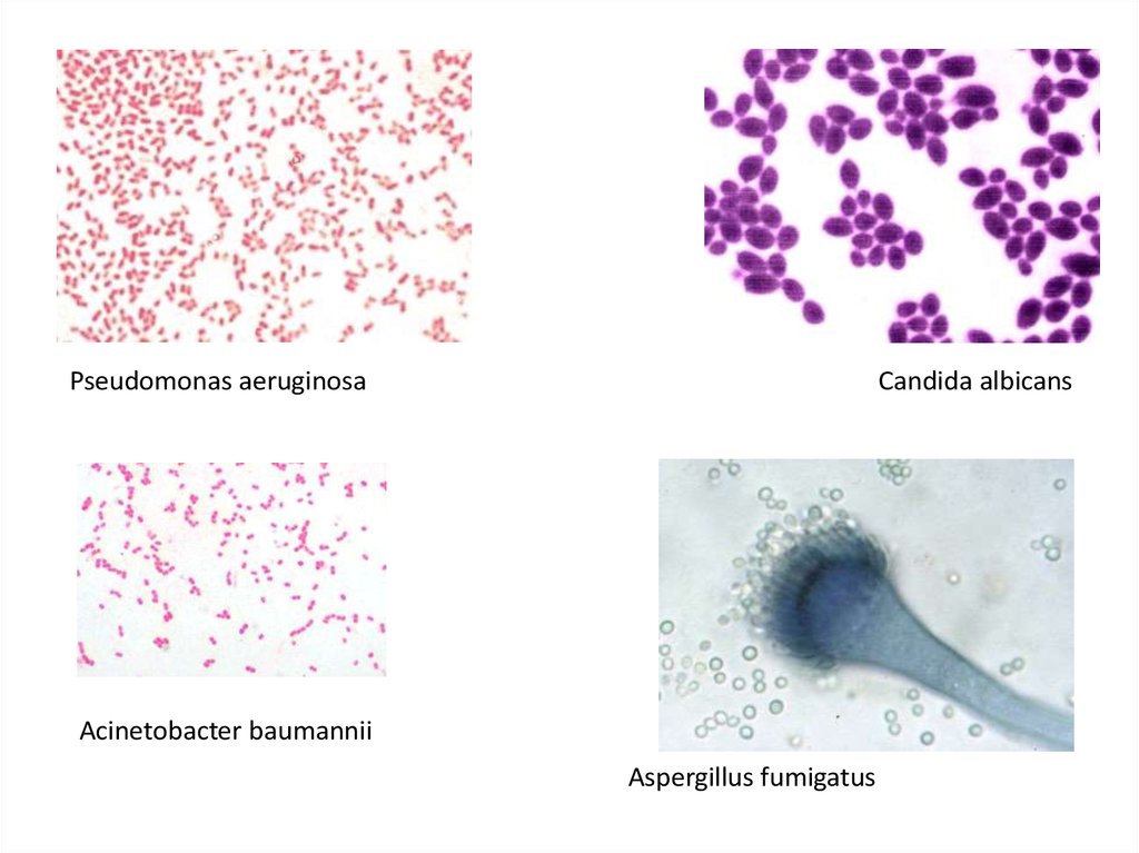 Candida albicans у ребенка