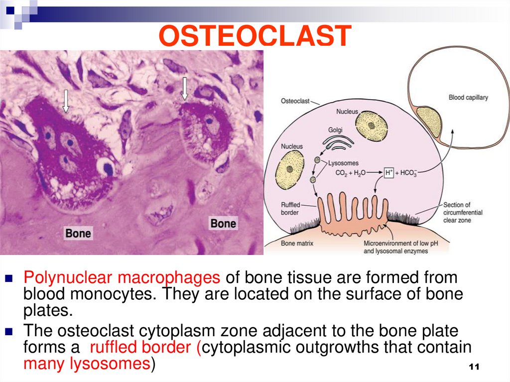 OSTEOCLAST