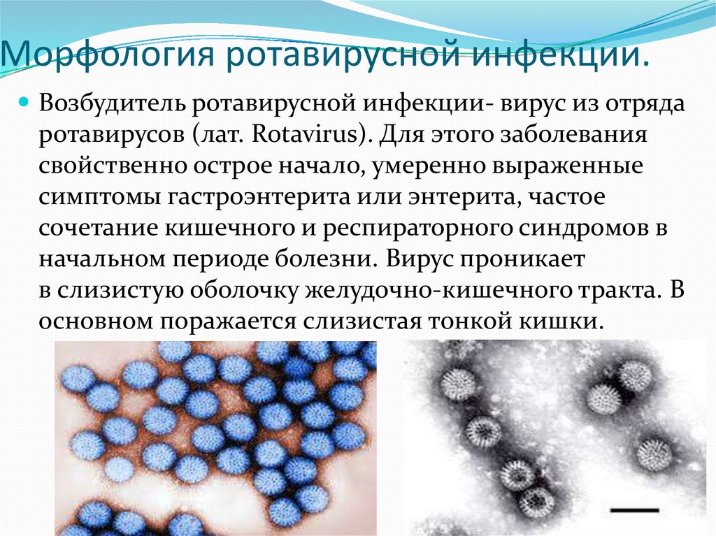 Ротавирусный энтерит. Ротавирусы микробиология строение. Возбудитель ротавирусной инфекции. Ротавирусная инфекция возбудитель инфекции. Возбудитель ринувирусной инфекции.