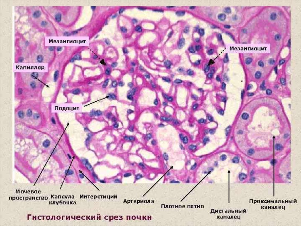 Почка гистология. Мезангиоциты гистология. Строение клубочка почки гистология. Нормальный клубочек почки гистология. Строение почечного клубочка гистология.