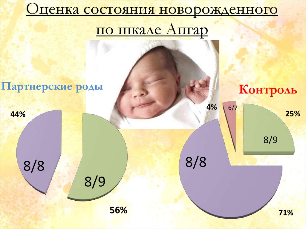 Оценка состояния новорожденного презентация