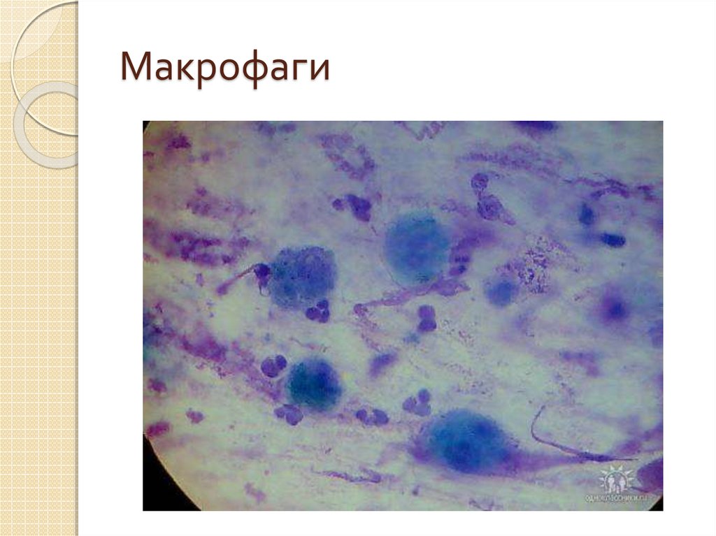 Макрофаги 4. Макрофаги гистология. Макрофаг в микроскопе. Пенистые макрофаги цитология. Фиксированные макрофаги печени.