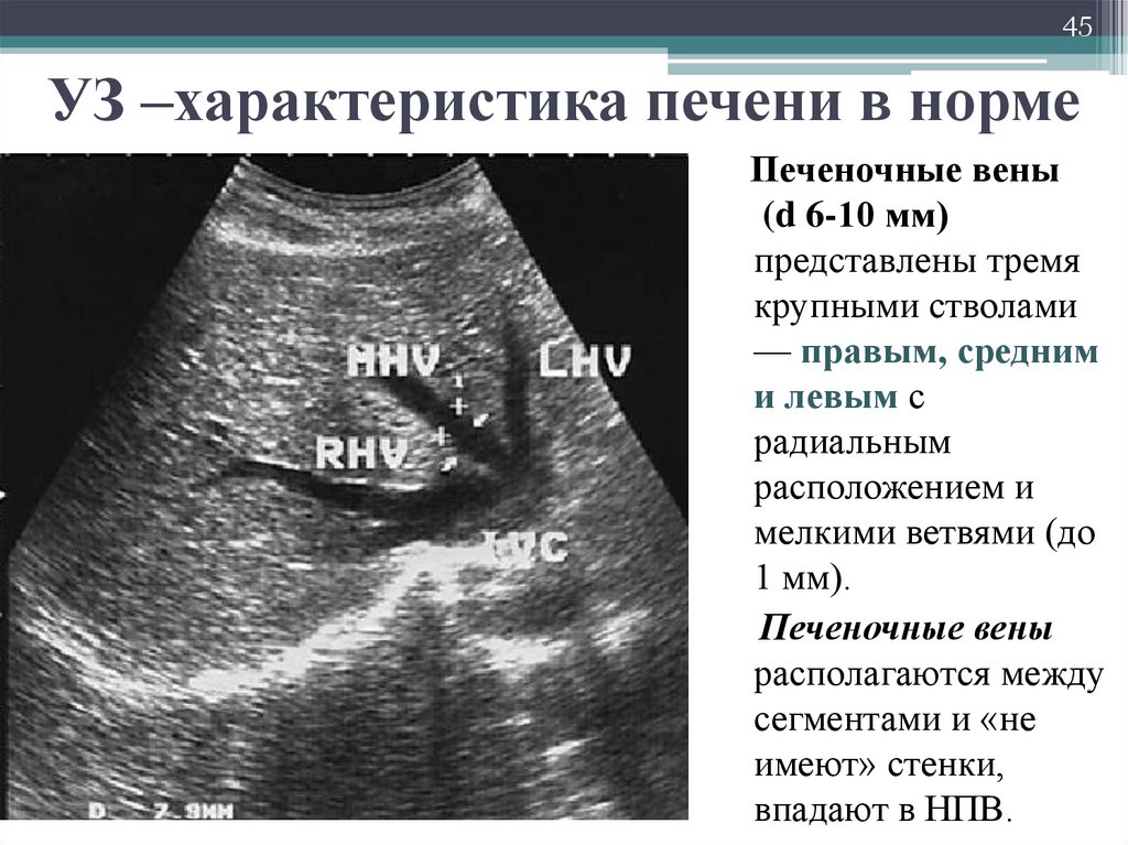 Квр печени. УЗИ печени нормальные показатели. УЗИ печени нормальные показатели таблица. Показатели УЗИ печени норма. УЗИ печени показатели нормы у детей.