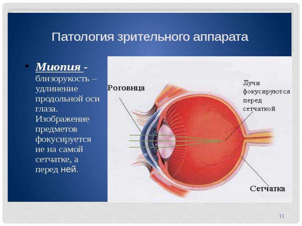 Перед сетчаткой расположена. Строение сетчатки глаза. Лазерная коагуляция сетчатки глаза. Сетчатка глаза рисунок. Секторальная лазеркоагуляция сетчатки.