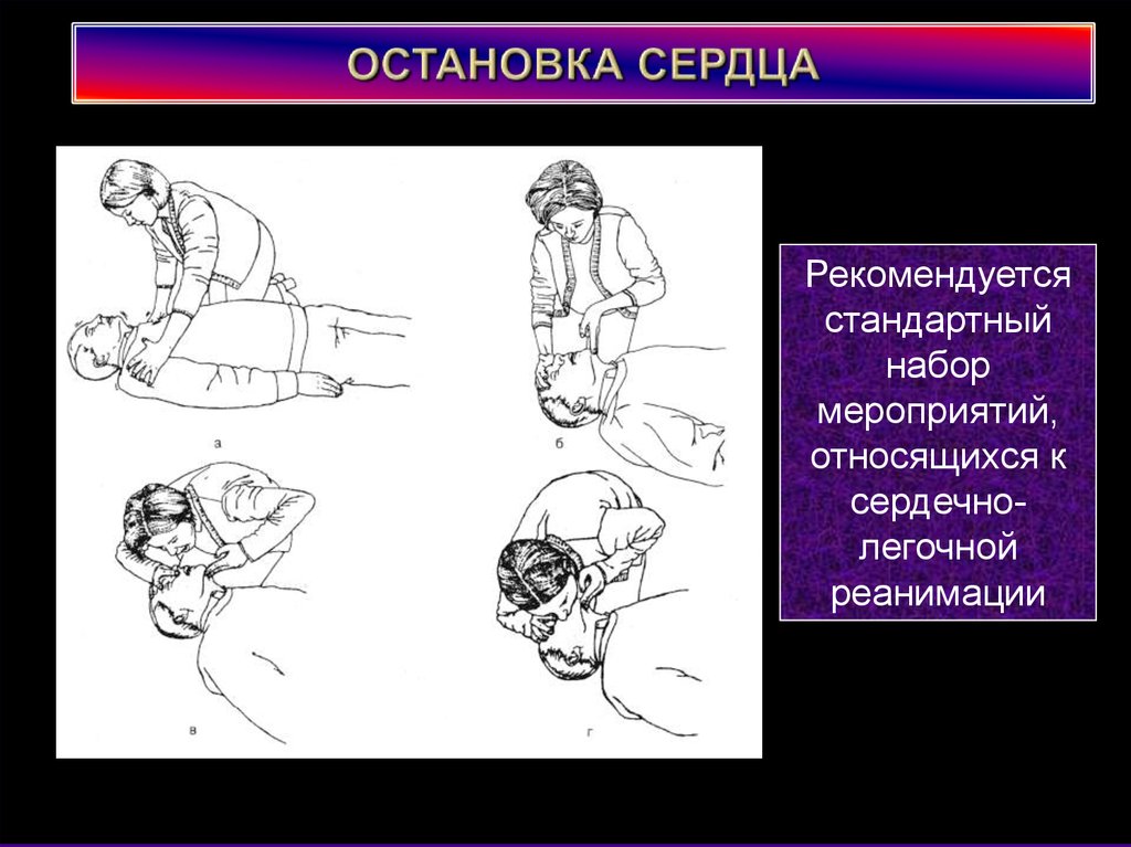 Проект остановка сердца