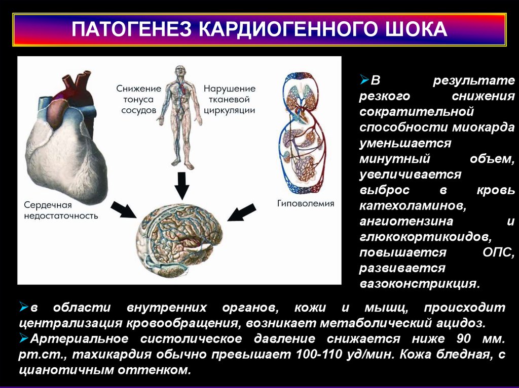 Кардиогенный шок наиболее часто. Кардиогенный ШОК патогенез. Истинный кардиогенный ШОК патогенез. Осложнения кардиогенного шока. Кардиогенный ШОК этиология патогенез.