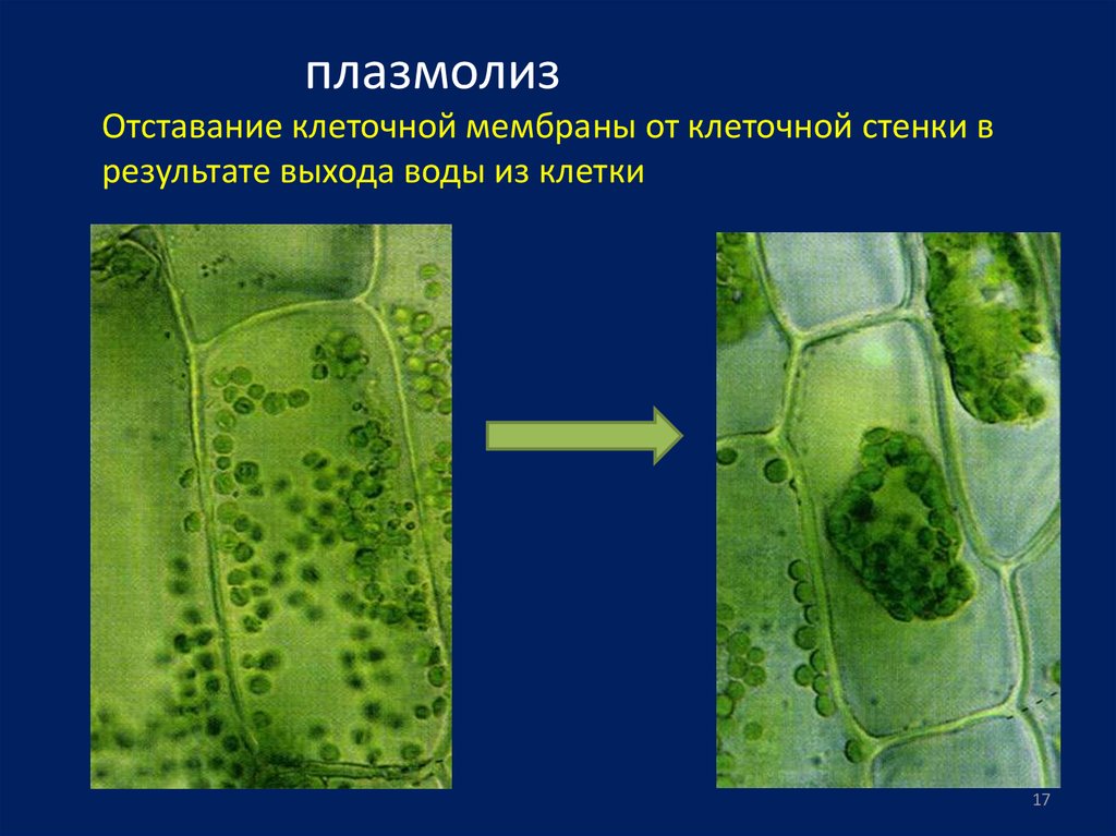 Особенности внутреннего строения элодеи. Осмос тургор плазмолиз. Плазмолиз и деплазмолиз в растительной клетке. Тургор и плазмолиз в клетках листа элодеи. Плазмолиз элодеи.