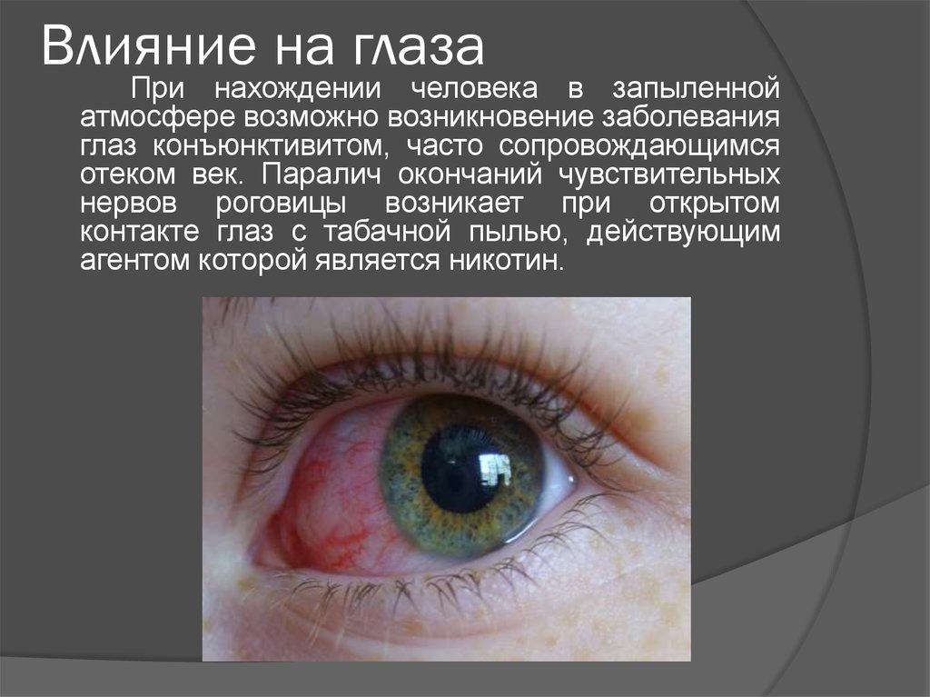 Общие заболевания глаза. Воздействие на зрение человека. Причины влияющие на зрение человека. Механическое воздействие на глаза.