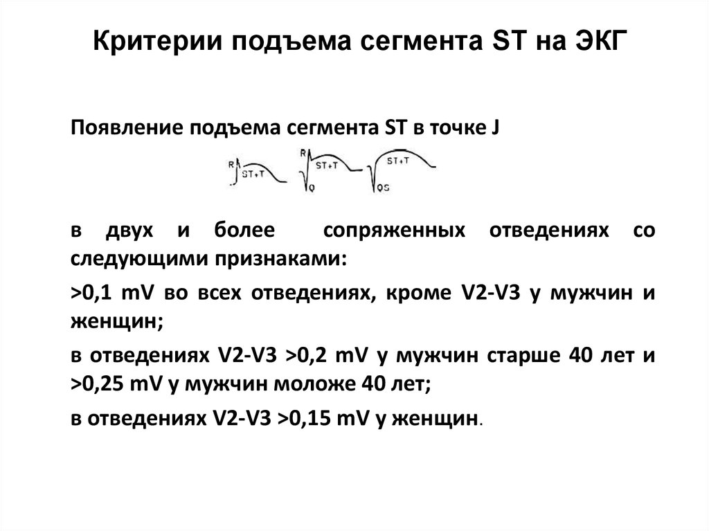 Подъем сегмента