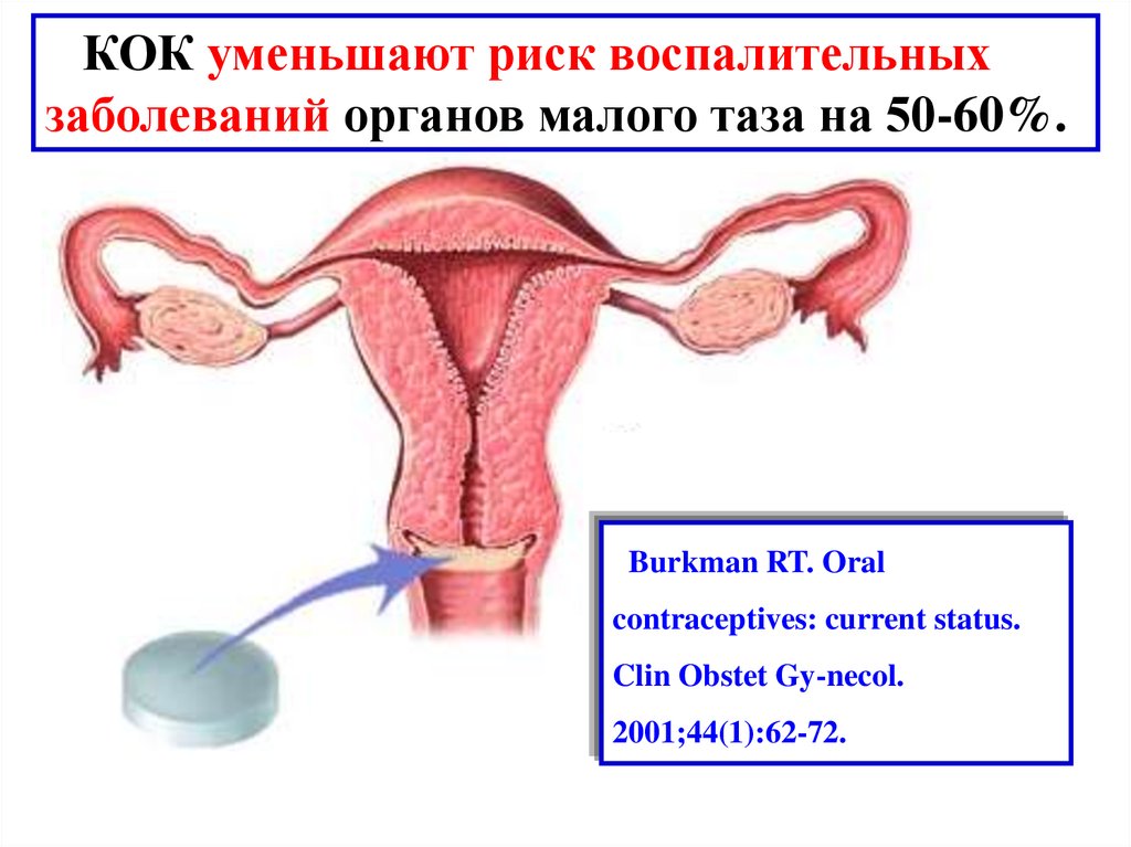 Презентация комбинированные оральные контрацептивы