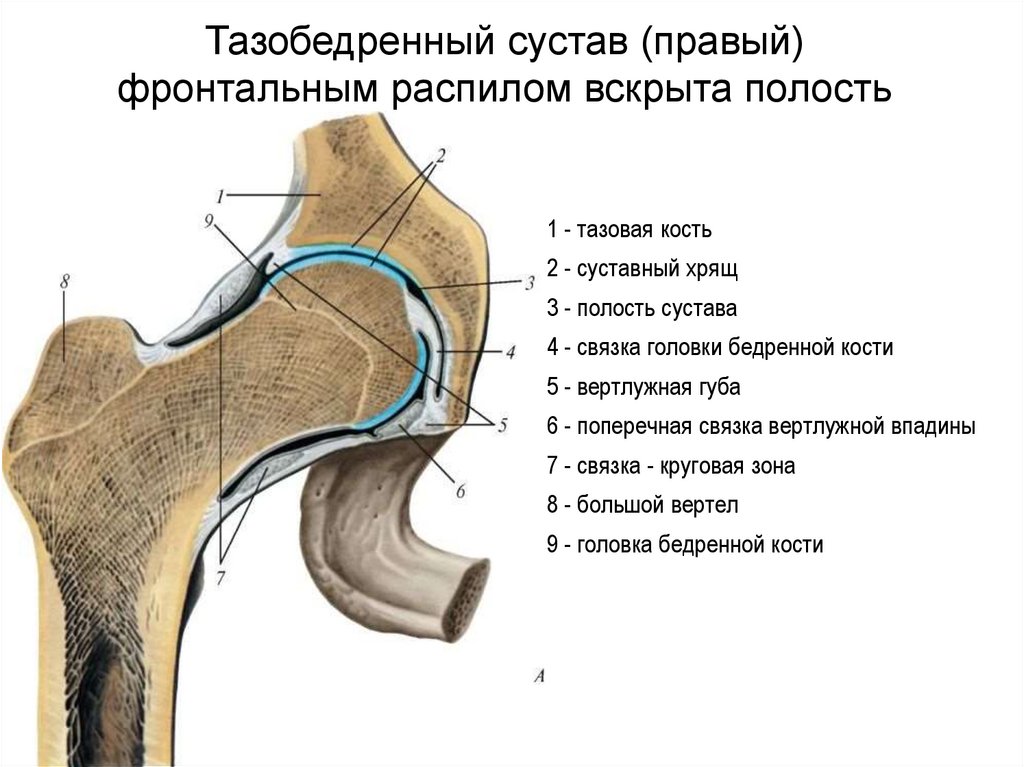 Тазобедренный сустав (правый) фронтальным распилом вскрыта полость