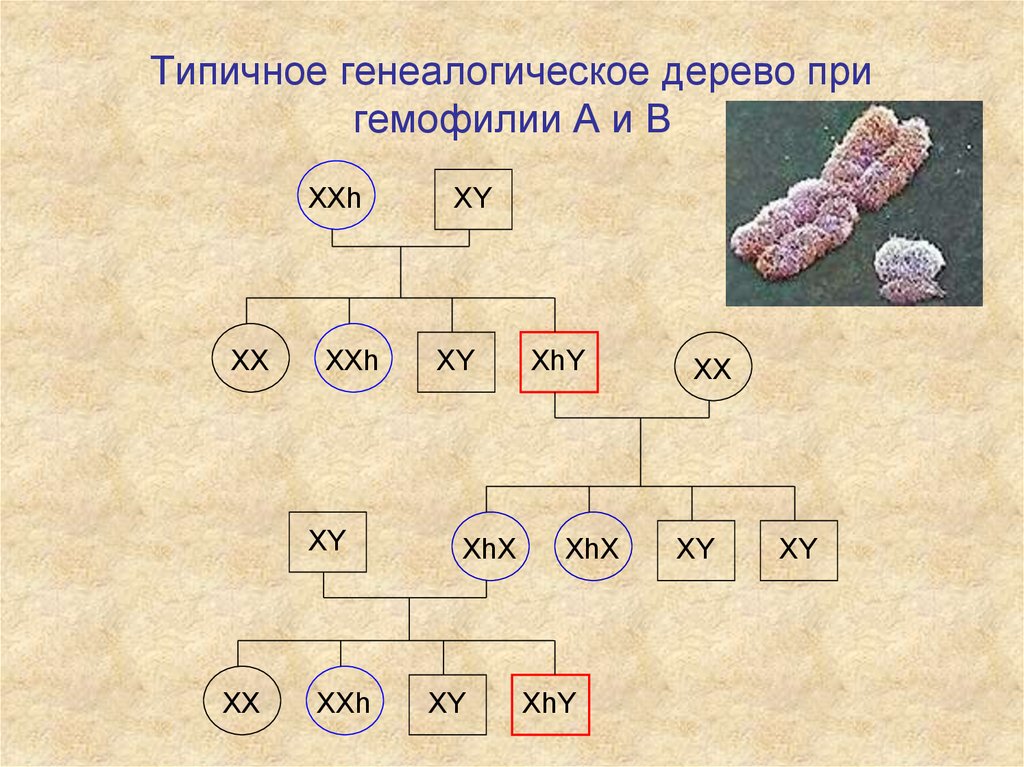 Типичное генеалогическое дерево при гемофилии А и В
