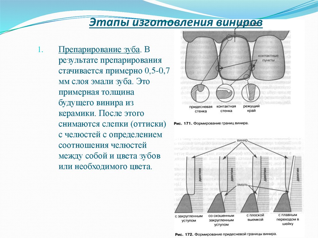 Этапы изготовления