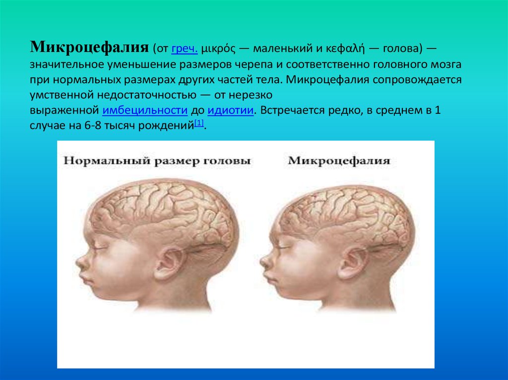 Изменения головного мозга у новорожденного