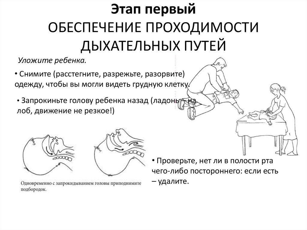 Последовательность действий по восстановлению проходимости