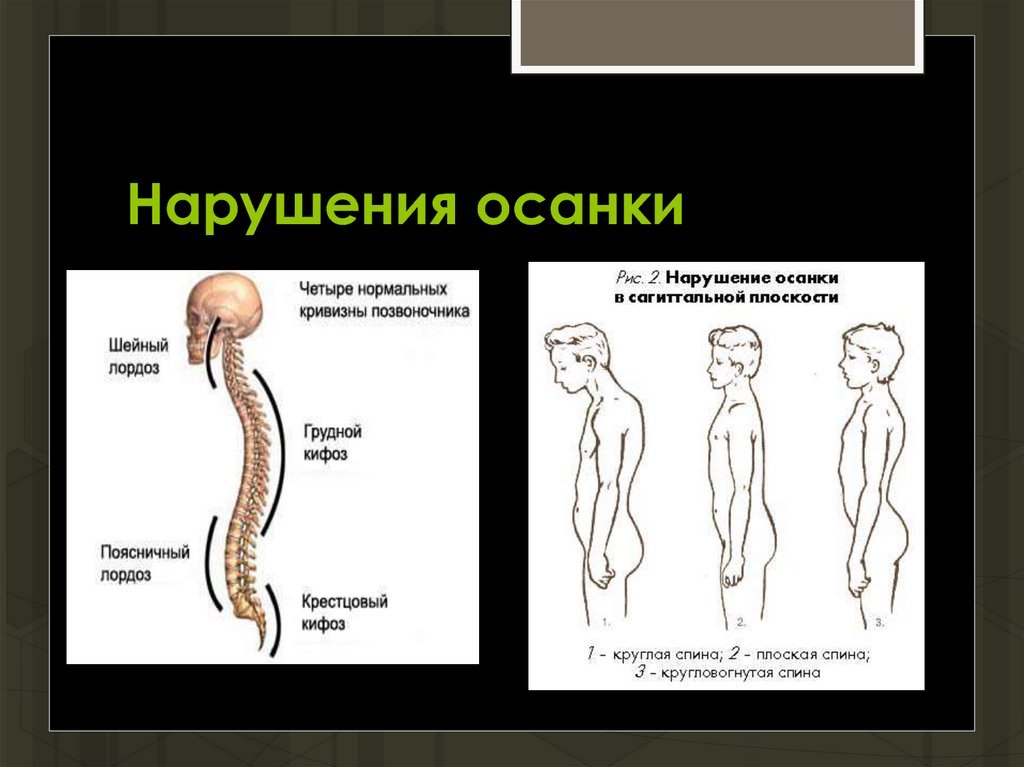 Картинки плоская спина