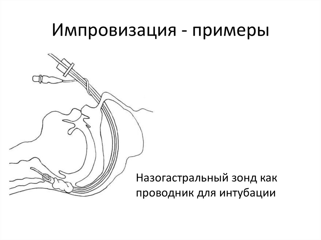 Введение назогастрального зонда. Назогастральный зонд фиксация. Назогастральный зонд промывание алгоритм. Назогастральный зонд при интубации. Назогастральный зонд постановка алгоритм.