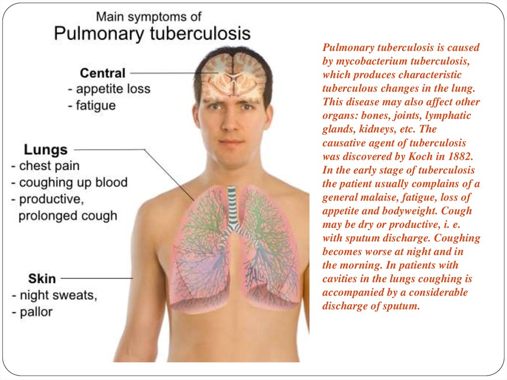 Туберкулез образ жизни. Основные проявления туберкулеза. Признаки проявления туберкулеза. Основные симптомы туберкулеза.