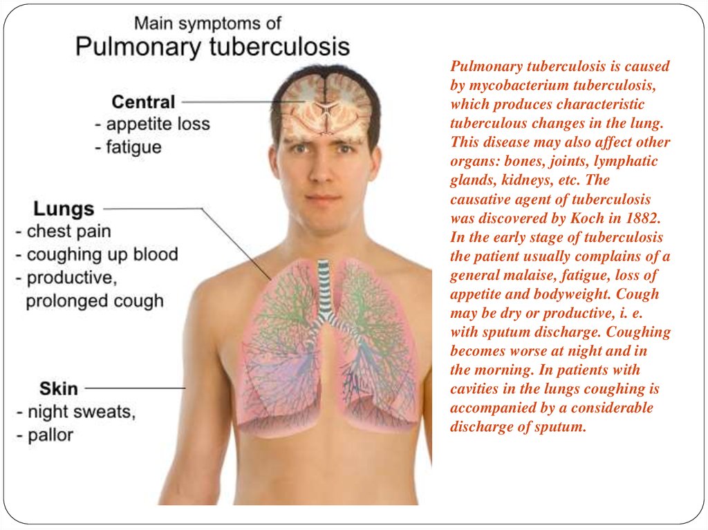 Как проявляется туберкулез. Основные проявления туберкулеза. Основные симптомы туберкулеза легких. Первичные симптомы туберкулеза легких. Чахотка симптомы у взрослых.
