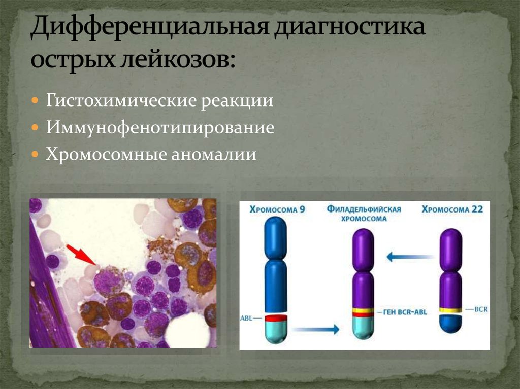 Дифференциальная диагностика лейкозов презентация - 92 фото