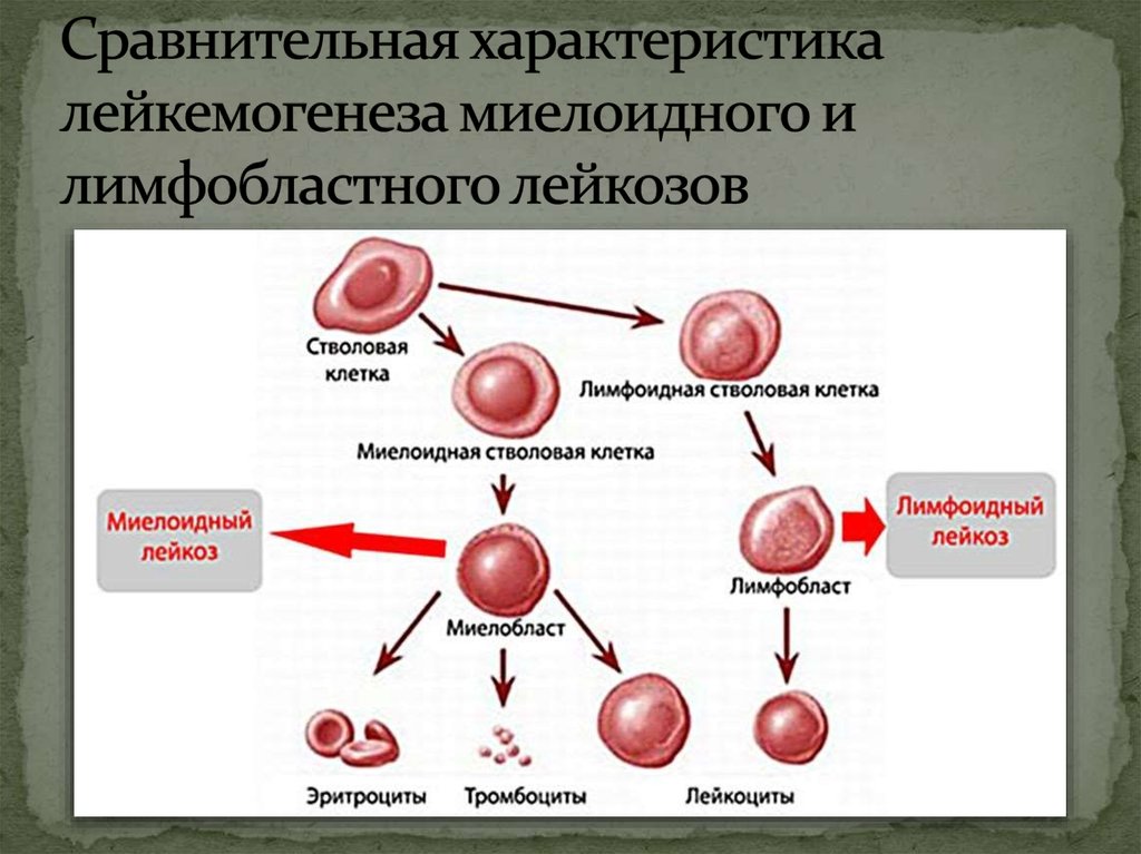 Первые признаки крови у детей. Острый миелобластный лейкоз схема. Острый миелобластный лейкоз картина крови. Острый миелоцитарный лейкоз. Миелоидный и лимфоидный лейкоз.