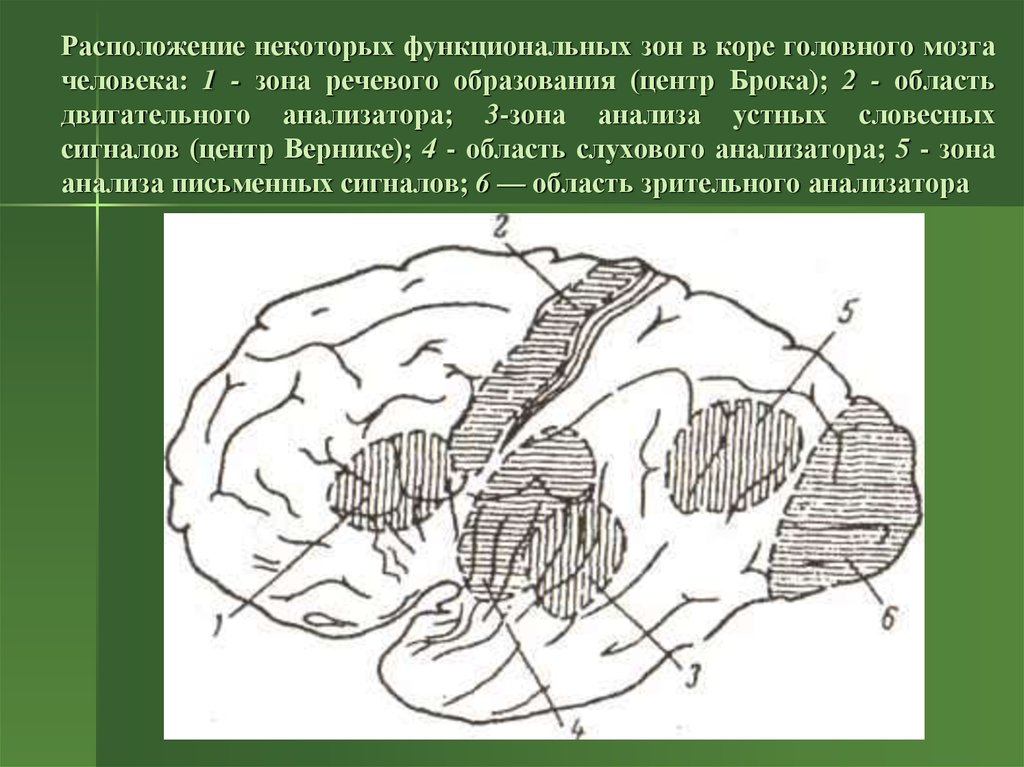 Местоположение некоторые. Речевые зоны коры головного мозга. Речевой центр Брока. Речевые зоны коры головного мозга Брока. Центр Брока и Вернике.
