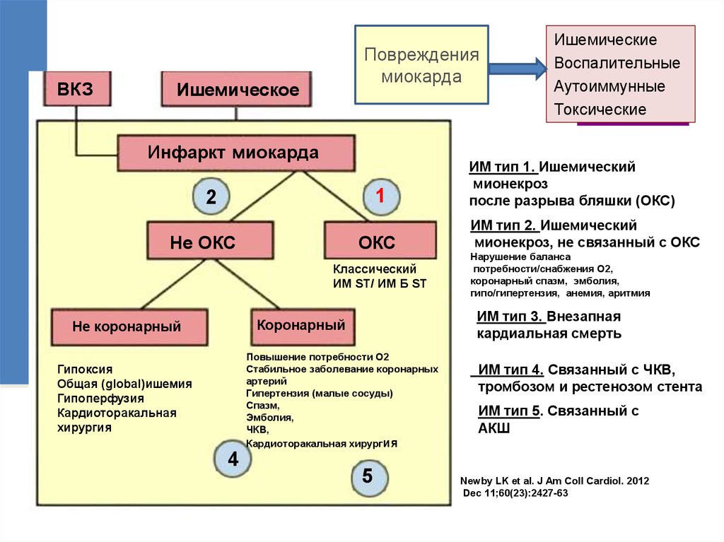 Диагностика инфаркта миокарда