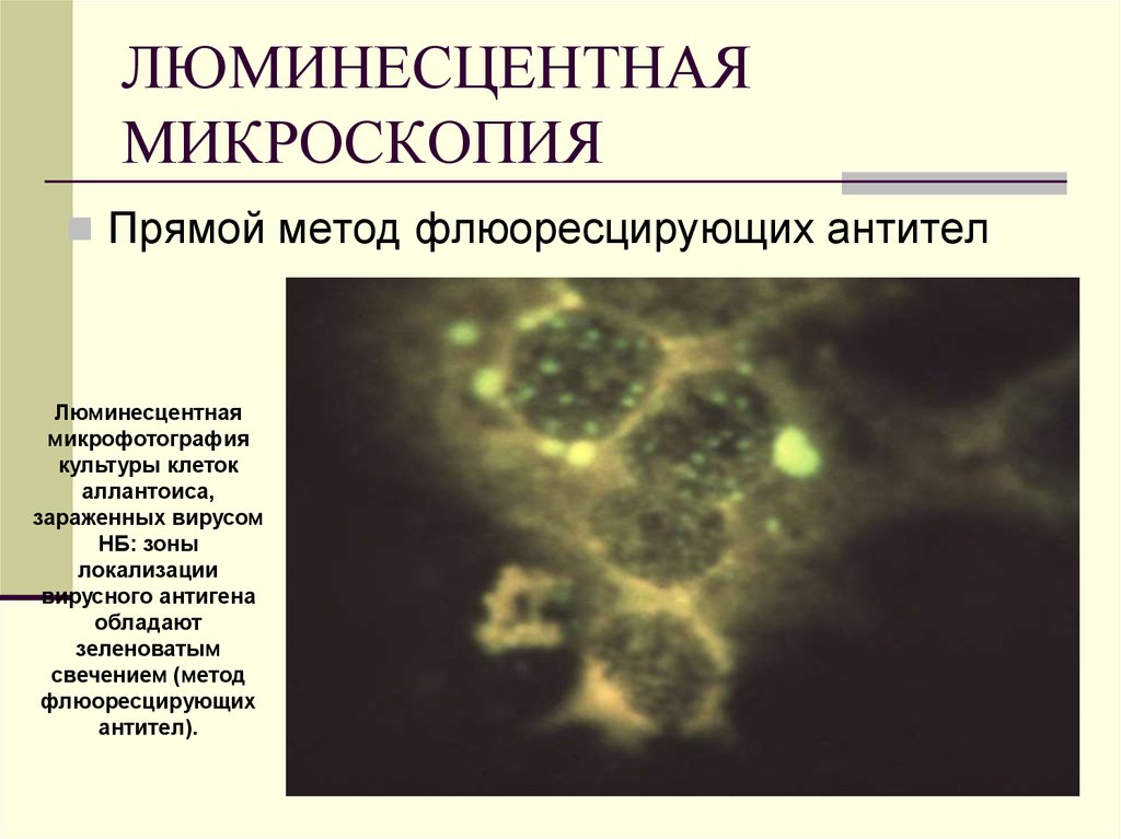 Микроскопией называют метод микроскопии. Люминесцентная микроскопия бактерий. Люминесцентная микроскопия хламидий. Люминесцентная микроскопия микробиология. Метод люминесцентной микроскопии.