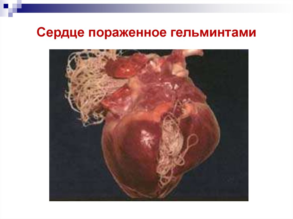 Сердце пораженное гельминтами