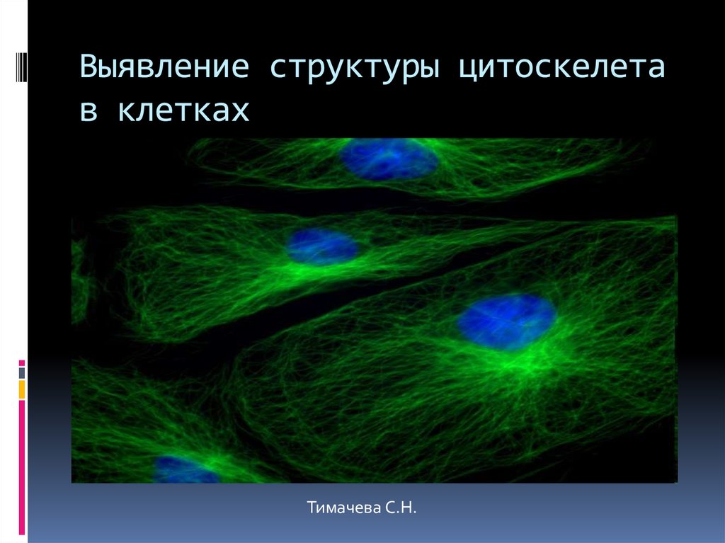 Цитоскелет клетки. Болезни цитоскелета. Единицы цитоскелета. История обнаружения клетки. Какая наука изучает рост клетки