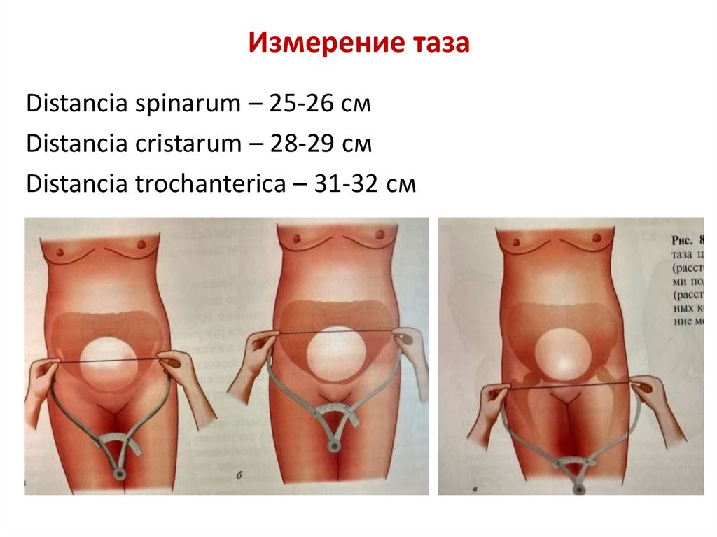 Измерение таза. Измерение таза беременной тазомером. Размеры таза в акушерстве измерение. Ширина таза как измерить. Измерения таза беременной в акушерстве.