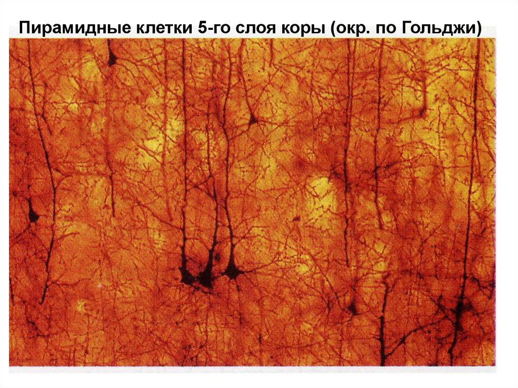 Клетки беца. Гигантские пирамидные клетки Беца. Клетки Беца гистология. Клетки Беца коры больших полушарий. Пирамидный Нейрон (клетка Беца)..