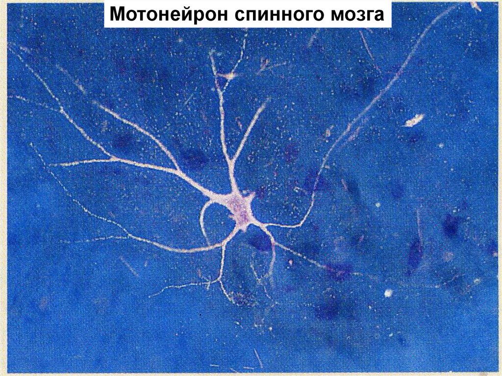 Нейроны спинного мозга характеристика. Гамма мотонейроны спинного мозга. Альфа мотонейрон. Спинальные мотонейроны. Мотонейроны спинного мозга иннервируют.