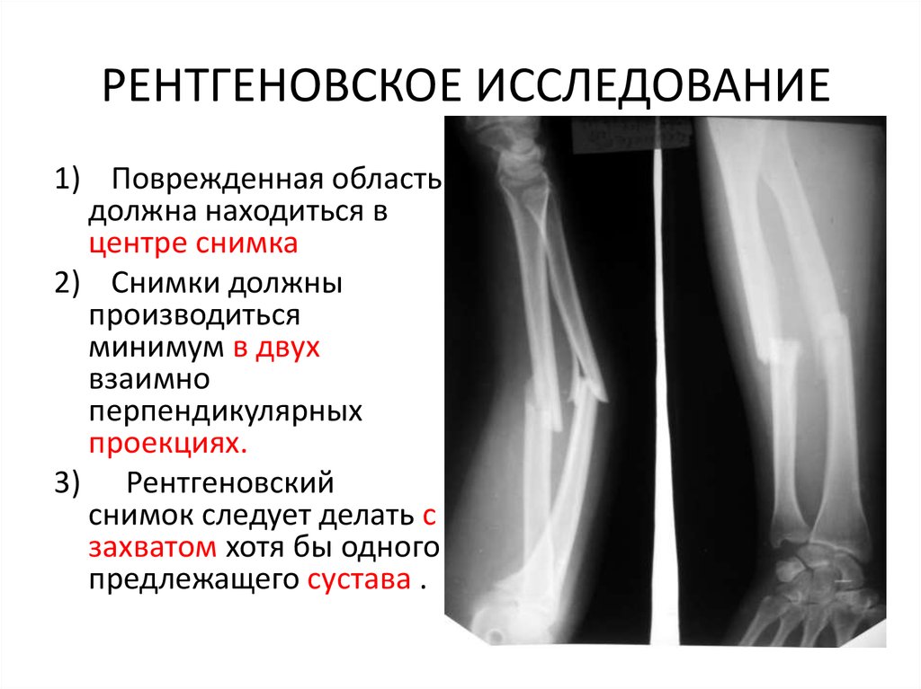 Рентгеновское исследование