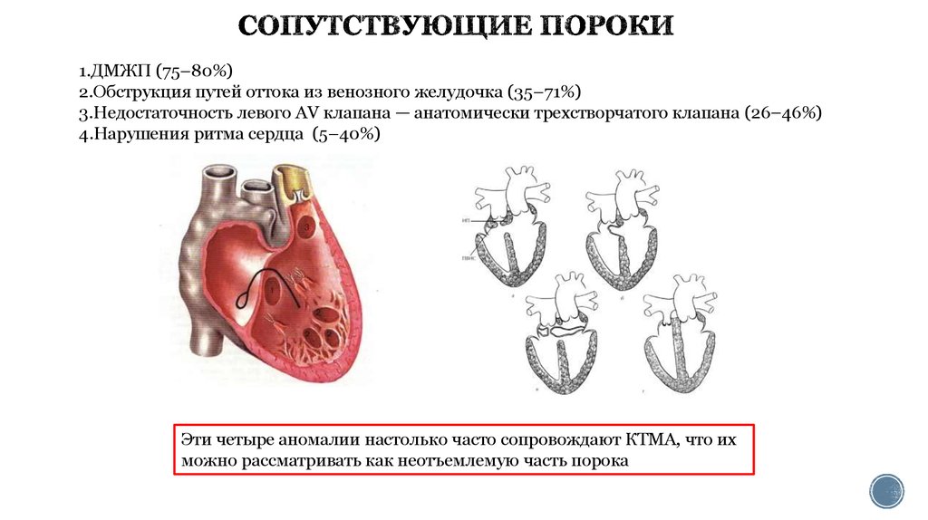 Ала с дмжп тест нмо ответами. Пороки трехстворчатого клапана. Двойное отхождение магистральных сосудов от правого желудочка. Гемодинамика при дефекте межжелудочковой перегородки. Операции при дефекте межжелудочковой перегородки.